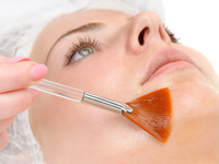 peeling